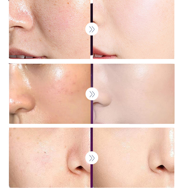 Luxo nobre senhora pérola bran - Luxury Skincare Whitening Cream avaliação e preço