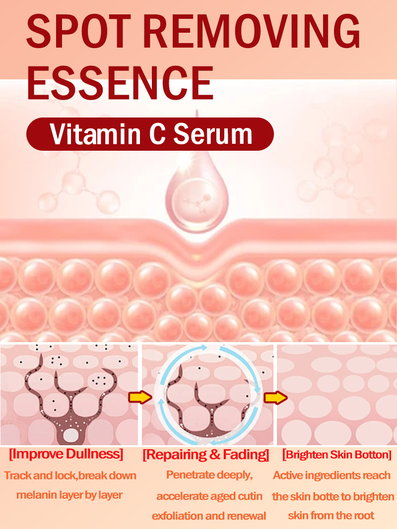 Ilumine sardas melasma, mancha - Luxury Skincare Essence avaliação e preço